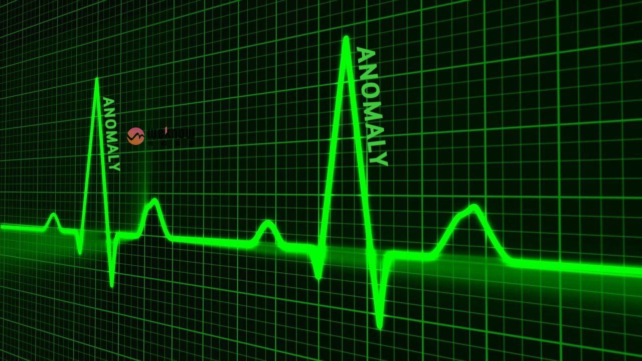 异常入侵检测是什么